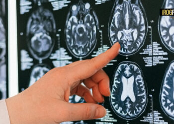 MALATTIA DI PARKINSON. L’ASSESSORE LANZARIN ILLUSTRA IL MODELLO VENETO PER CONTINUITÀ E OMOGENEITA’ NELLA PRESA IN CARICO DEI PAZIENTI